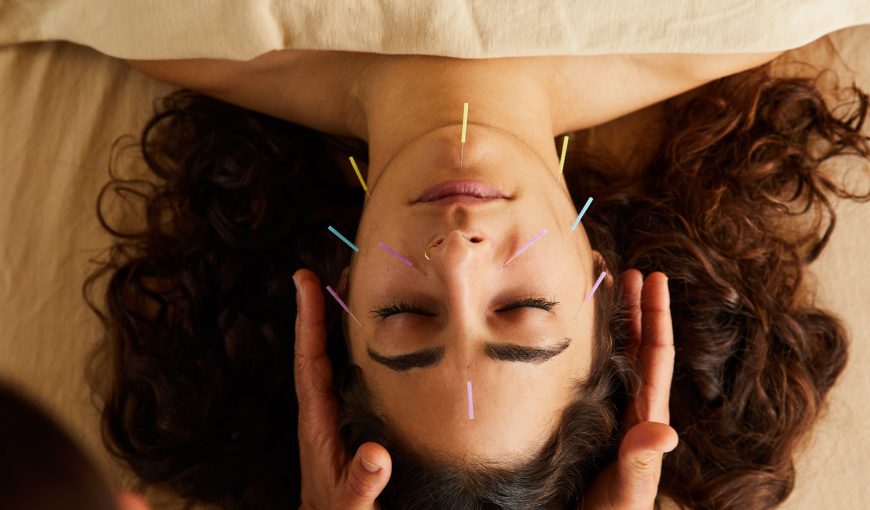 A Sanctuary Body acupuncture client rests peacefully